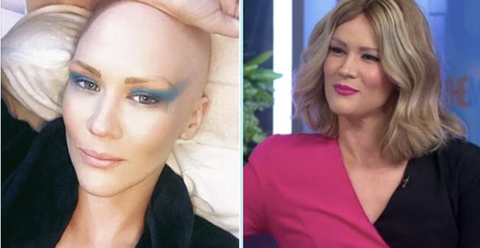 Retrosweat’s Shannon Dooley reveals her battle with Alopecia on The Morning Show Retrosweat’s Shannon Dooley reveals her battle with Alopecia on The Morning Show