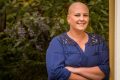 Launceston woman shares her Alopecia Areata Story