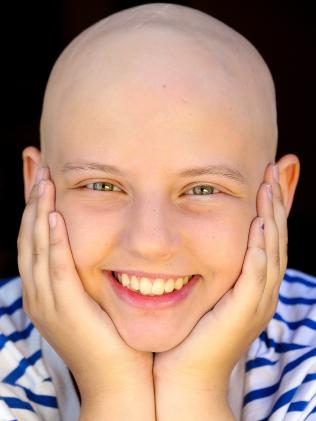Stella shares alopecia story