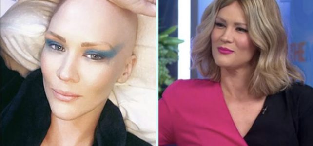 Retrosweat’s Shannon Dooley reveals her battle with Alopecia on The Morning Show